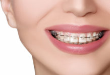 CAD – nowoczesna technika leczenia ortodontycznego fot. Fotolia