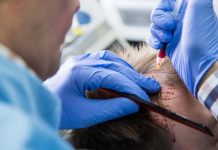 Osocze naprawdę bogatopłytkowe – czyli o skuteczności tego zabiegu