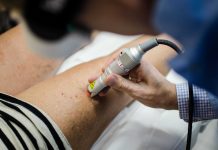 Naczynka na nogach – jak się ich pozbyć?
